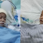 Bayi kembar siam asal Kendari, Sulawesi Tenggara, Aqila dan Azila berhasil dipisahkan oleh tim dokter RSUD dr. Soetomo, Surabaya. foto: istimewa