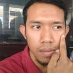 Rohaiman Hidayat, salah satu korban pemukulan menunjukkan bekas luka memar di wajahnya. foto: IWAN IRAWAN/ BANGSAONLINE