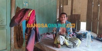 Kakek Penderita Hernia Puluhan Tahun di Sampang Dikunjungi Kemensos