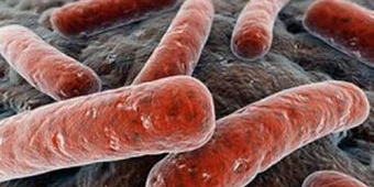 ​Waspada! Bakteri Pemakan Daging Hancurkan Tubuh dalam Beberapa Jam