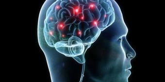 Waspadai Penyebab dan Tanda-Tanda Pendarahan di Otak 