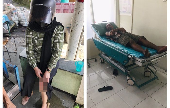 Tabrak WIL hingga Terluka Parah, Pria Semolowaru Surabaya Dilarikan ke Rumah Sakit
