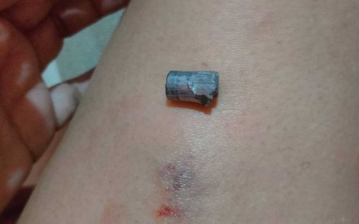 Suami Korban Peluru Nyasar di Gubeng Klingsingan Surabaya Akui Alami Trauma Suami Korban Peluru Nyasar di Gubeng Klingsingan Surabaya Akui Alami Trauma