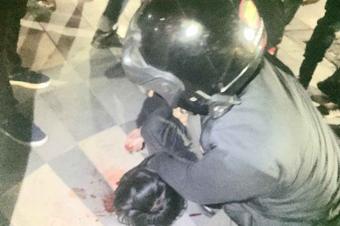 Operasi Zebra Semeru, Polrestabes Surabaya Amankan Pengemudi Motor Mabuk yang Tabrak Wartawan Operasi Zebra Semeru, Polrestabes Surabaya Amankan Pengemudi Motor Mabuk yang Tabrak Wartawan
