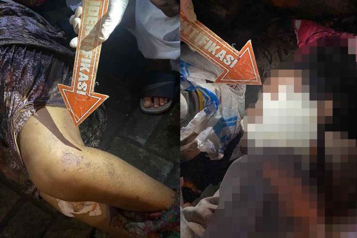 Diduga Korban Tabrak Lari, Wanita Tanpa Identitas di Sidoarjo Ditemukan Meninggal Dunia Diduga Korban Tabrak Lari, Wanita Tanpa Identitas di Sidoarjo Ditemukan Meninggal Dunia