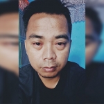 Salah satu penderita penyakit mata memerah di Kabupaten Sampang, Moh Heri. Foto: MUTAMMIM/BANGSAONLINE