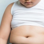 7 Bahaya Obesitas Pada Anak, Ini Penjelasannya. Foto: Ist