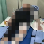 Korban SEY saat menjalani perawatan di RS. Unair Surabaya usai jadi korban jambret di depan Grand City Surabaya.