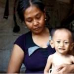 Dwi Setiawan balita penderita gizi buruk bersama ibunya. Foto: Soewandito/BANGSAONLINE