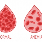 Tips Mencegah Anemia Pada Remaja. Foto: Ist