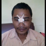 Korban Miftahkhul Arifin mengalami luka di bagian hidung. foto: AKINA/ BANGSAONLINE