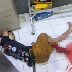 Satu dari tiga terduga pelaku tampak tergeletak tak berdaya di Mapolres Jember dengan kaki diperban akibat bekas luka tembakan. 