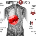 Ilustrasi penyakit Hepatitis A.