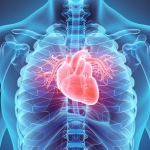 Cara Mencegah Penyumbatan Setelah Pasang Ring Jantung. Foto: Ist