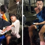Kedua korban luka akibat dibacok di Taman Sejarah kawasan Kota Lama Surabaya saat mendapat penanganan medis dari tim TGC.