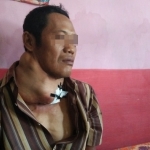 BUTUH ULURAN TANGAN: Kondisi tumor Sukadi yang semakin parah. Tampak luka-lukanya yang hanya ditutupi dengan plester seadanya. Foto: RONY S/BANGSAONLINE