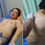 Kondisi tubuh Yusra Valentino setelah dianiaya oleh preman yang diduga suruhan mantan istri.