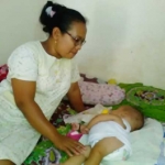 Balita penderita hydrocephalus asal Kerek yang butuh bantuan.