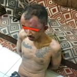 Kondisi pelaku yang babak belur usai jadi bulan-bulanan warga