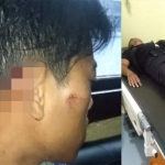 Anggota PSHT yang mengalami luka-luka akibat dilempari batu (foto kiri). Dan, anggota PSHT yang mengalami luka bacok mendapatkan perawatan di RS Bojonegoro.