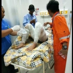 Korban luka bakar saat dirawat di RSUD Dr. Koesma.