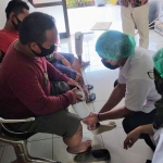 Proses pemasangan kaki palsu bagi 6 disabilitas dari Kabupaten Pamekasan.