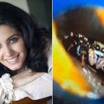 Penyanyi Katie Melua dan laba-laba yang bisa dikeluarkan hidup-hidup dari telinganya. foto: repro the telegraph