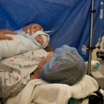 Ilustrasi tindakan operasi caesar kelahiran bayi.