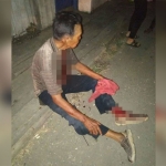 Foto seorang bapak yang duduk dengan tangan terputus ini sudah pernah beredar di medsos pada Agustus 2019 lalu. Peristiwanya terjadi luar Jawa, bukan korban begal di Mpu Tantular Kecamatan Buduran.
