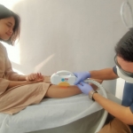 Salah satu pasien yang sedang melakukan treatment IPL Hair Removal.