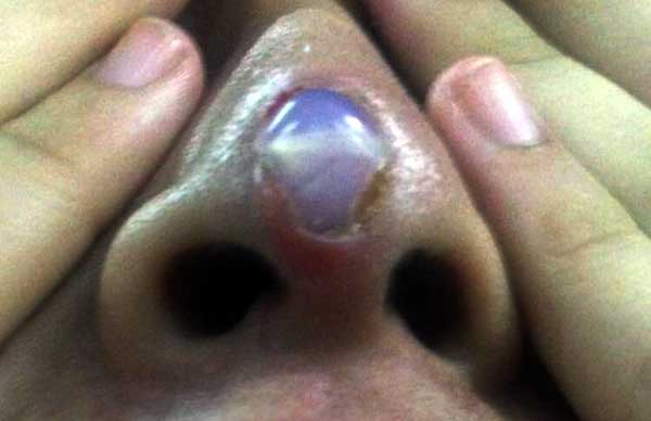 bentuk hidung yang aneh. foto: metro.co.uk