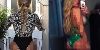 Menderita Sindrom Dysmorphia, Bokong Bianca Gascoigne Dipermak Jadi Bulat Berisi