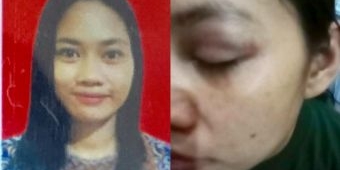Polisi Tetapkan Ibu 3 Anak di Surabaya Jadi Korban Penganiayaan dan Bukan KDRT, Mengapa?