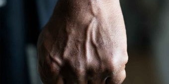 Tegur Pesta Miras, Anggota Polsek Mulyorejo jadi Korban Penganiayaan