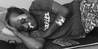 Lansia di Sampang Dianiaya Tetangga hingga Luka Serius