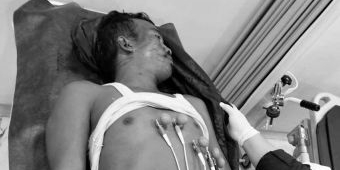 Pekerja Proyek Diduga Tewas Terjatuh di Area Pembangunan Ponpes Dalwa Pasuruan