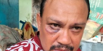Wartawan Memorandum di Pamekasan Jadi Korban Kekerasan saat Pejalanan Menuju Tempat Liputan