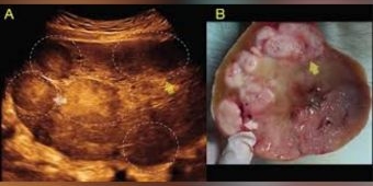Cuaca Sumenep Hari ini Senin, 19 Januari 2026: Diperkirakan Berawan dengan Suhu 24-29°C