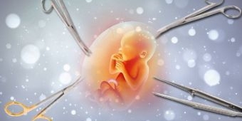 Amnesti Internasional Legalkan Aborsi