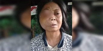 Jariah, Penderita Tumor Mata di Pacitan Belum Mendapatkan Bantuan Pengobatan