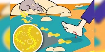 Puskesmas di Pacitan Tingkatkan Kewaspadaan Dini Soal Leptospirosis