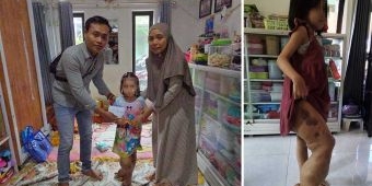 Idap Tumor Pembuluh Darah, Bocah 6 Tahun di Pamekasan Butuh Uluran Tangan