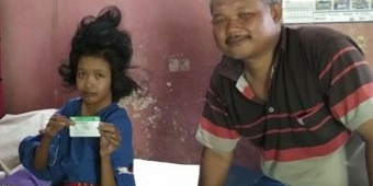 Rasakan Manfaatnya, Keluarga Penderita TOF di Madiun Berharap JKN-KIS Terus Ada