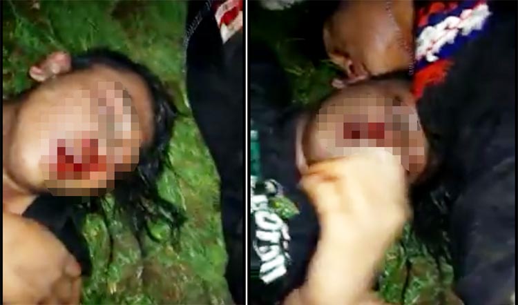 Kondisi terduga pelaku usai dihakimi massa.