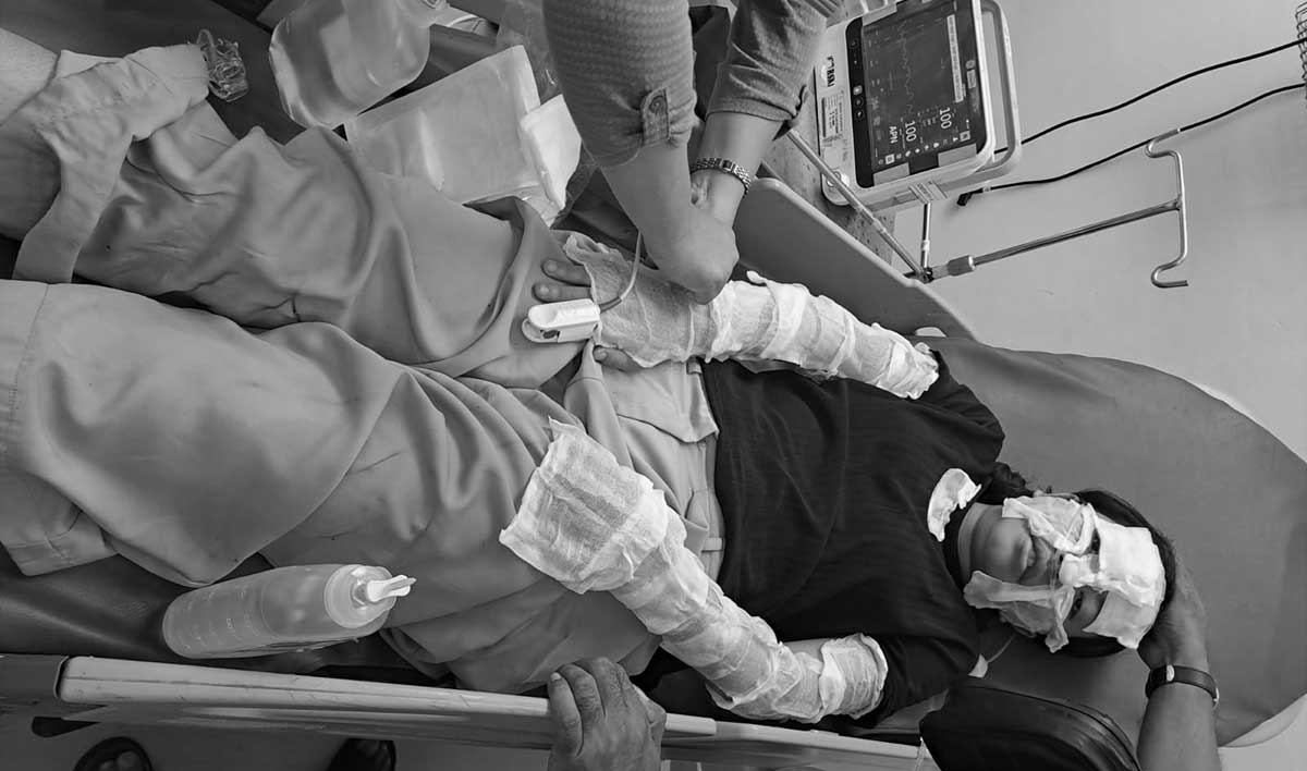 Korban ledakan kompor gas portabel di Surabaya.