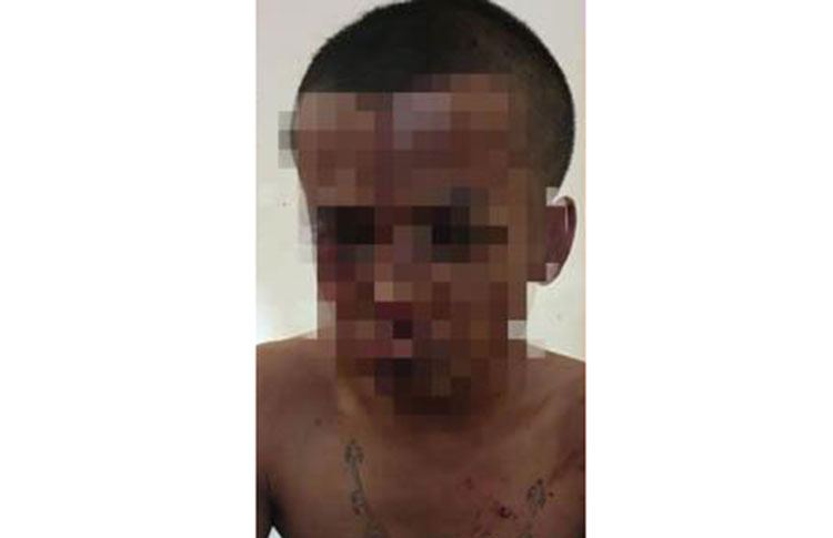 Moch. Ilyas (32), Warga Desa Sebani, Kecamatan Pandaan, satu dari dua pelaku jambret jalanan di Pasuruan. Karena aksinya berhasil digagalkan oleh korban, pelaku nyonyor dihakimi massa. (foto: ist)