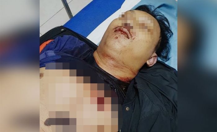Penonton Balap Liar di Sidoarjo Tewas Ditusuk Penonton Balap Liar di Sidoarjo Tewas Ditusuk