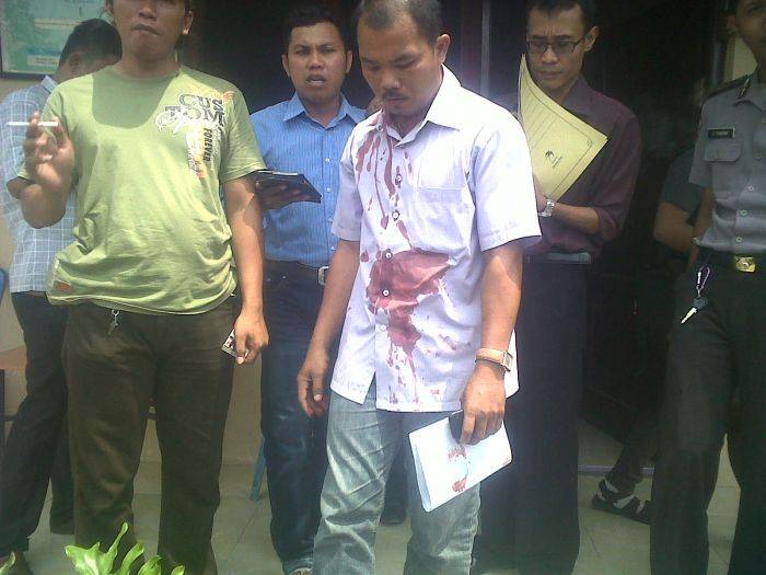 Seorang Aktivis Dibacok di Halaman Kecamatan Galis Madura