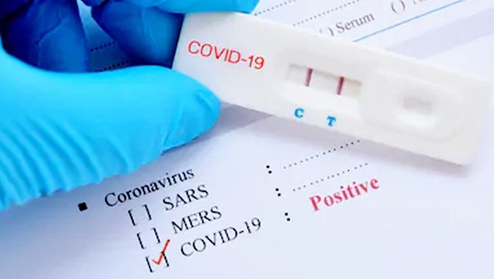 172 Orang Hasil Tracing Klaster Asrama Haji Siap Jalani Rapid Test, Ada Kadis Hingga Wartawan 172 Orang Hasil Tracing Klaster Asrama Haji Siap Jalani Rapid Test, Ada Kadis Hingga Wartawan