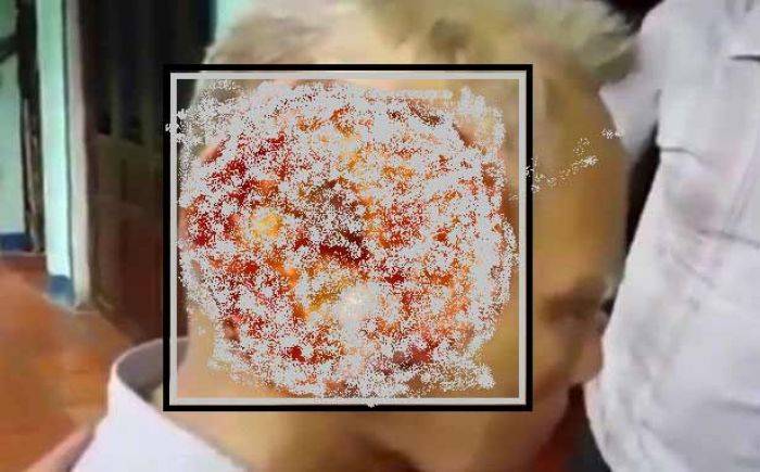 Digerogoti Virus, Separuh Kepala Ambyar Digerogoti Virus, Separuh Kepala Ambyar
